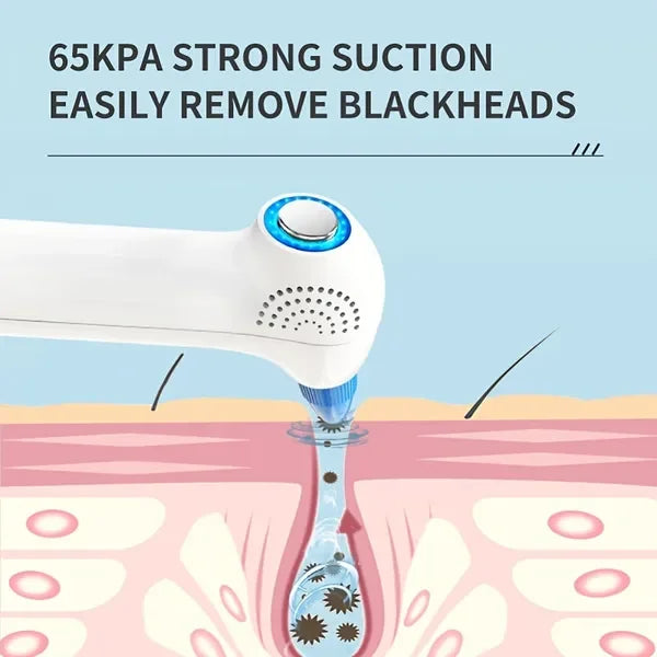 Blackhead Remover Pore Vacuum Upgraded Facial Pore Cleaner