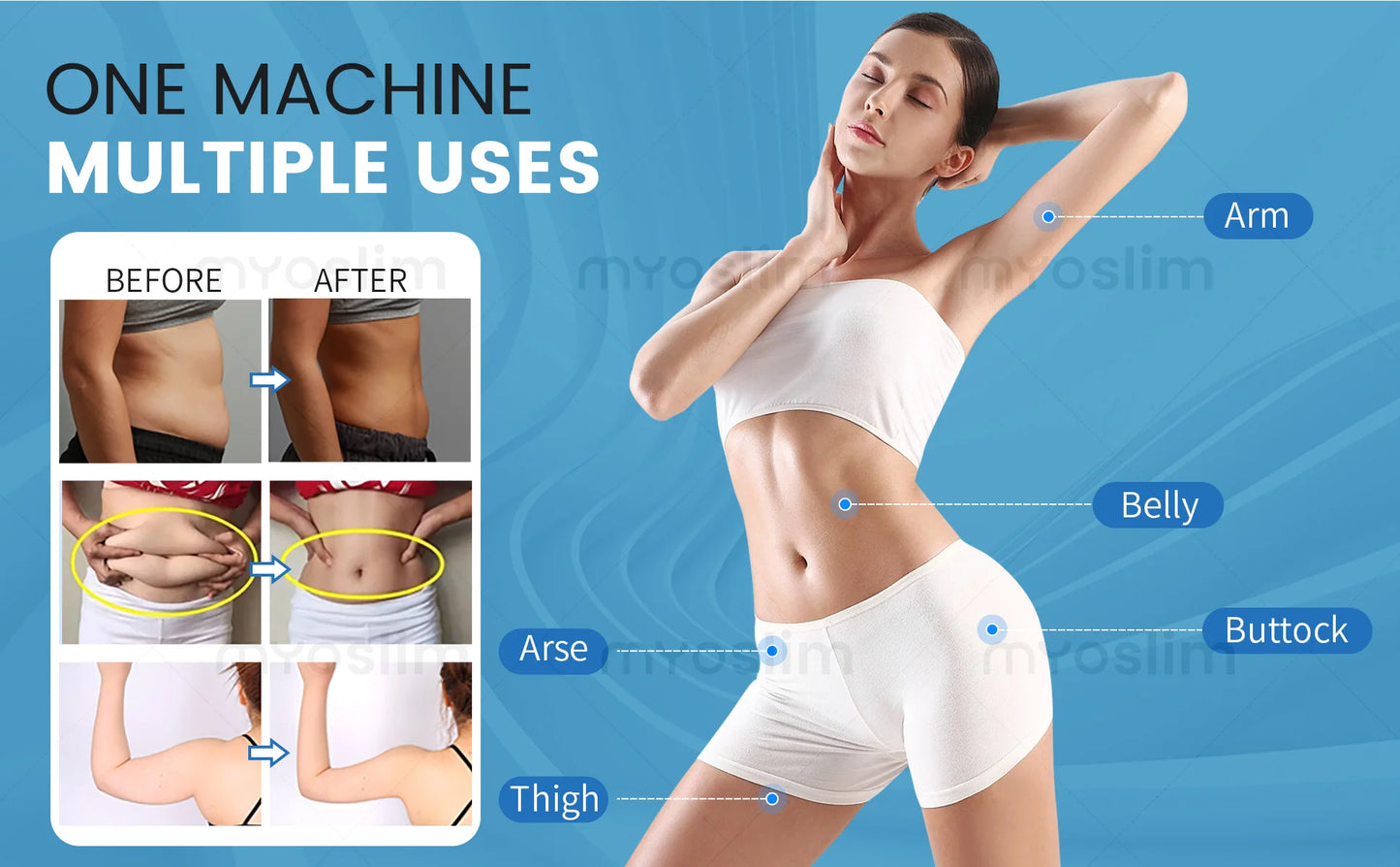 MYOSLIM 6500W EMS Body Slimming Machine For Electromagnetic Muscle Stimulation