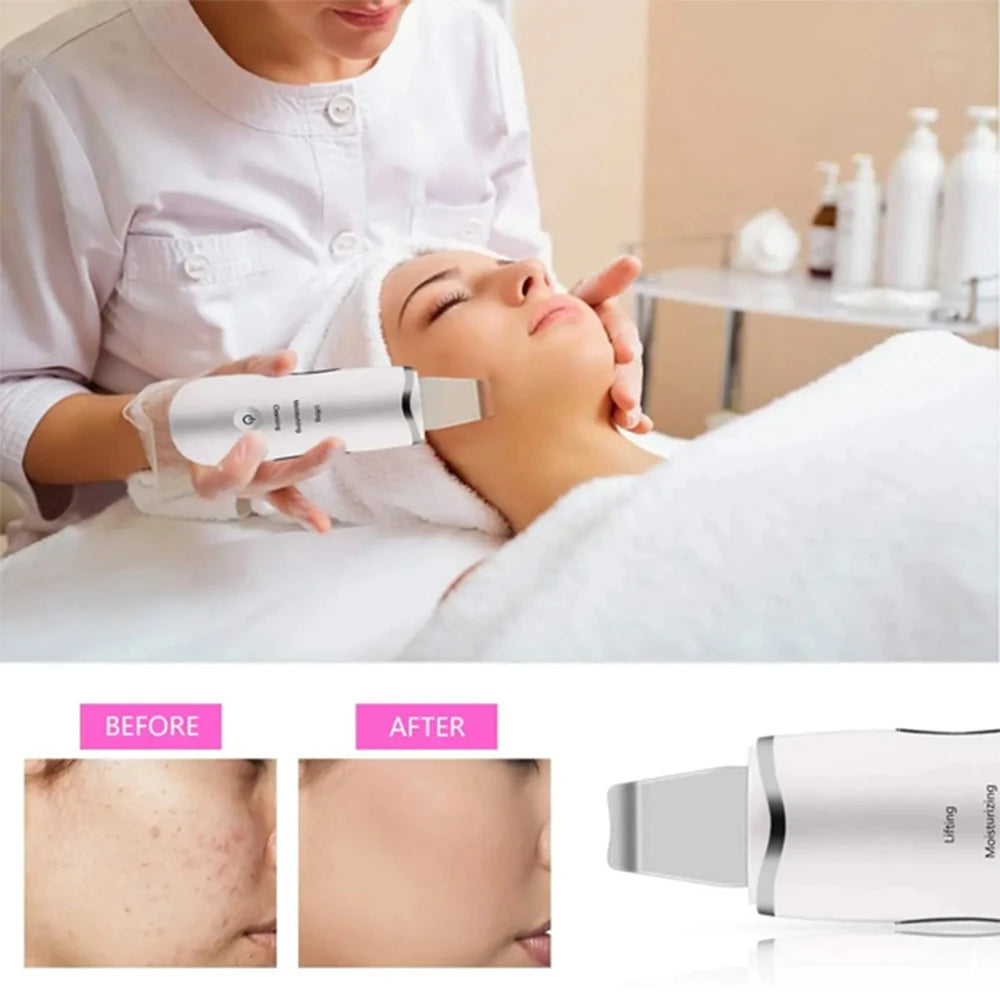 Three In One Ultrasonic Skin Scrubber Facial Cleanser Blackhead Remover