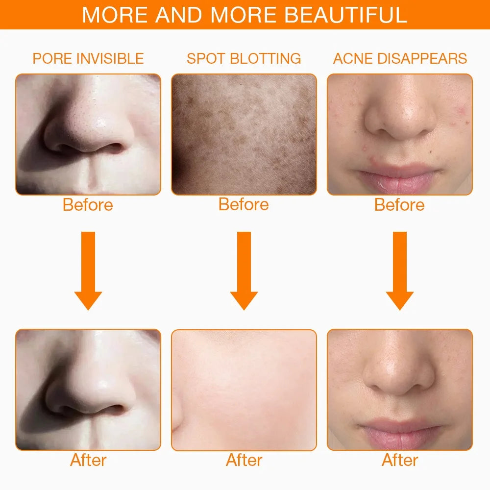Foreverlily LED Facial Mask With Neck Rejuvenation And Whitening