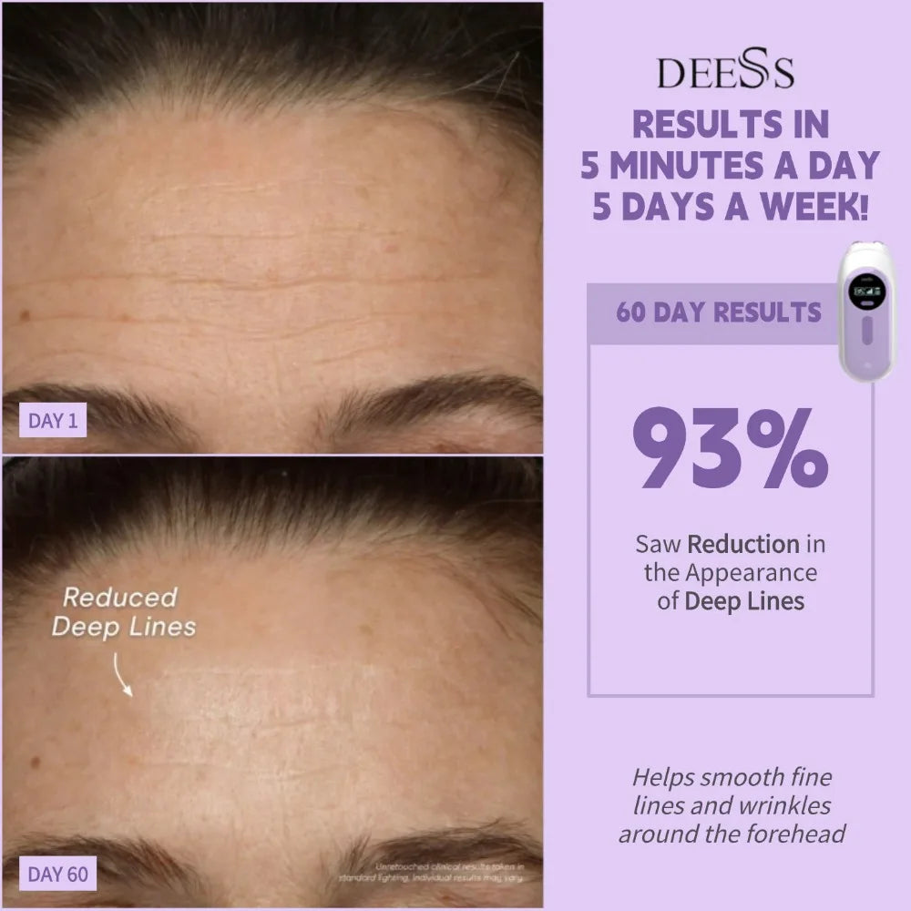 DEESS GP520 Facial Machine for Lifting and Anti Aging
