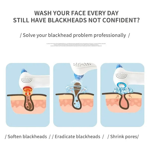 Blackhead Remover Pore Vacuum Upgraded Facial Pore Cleaner