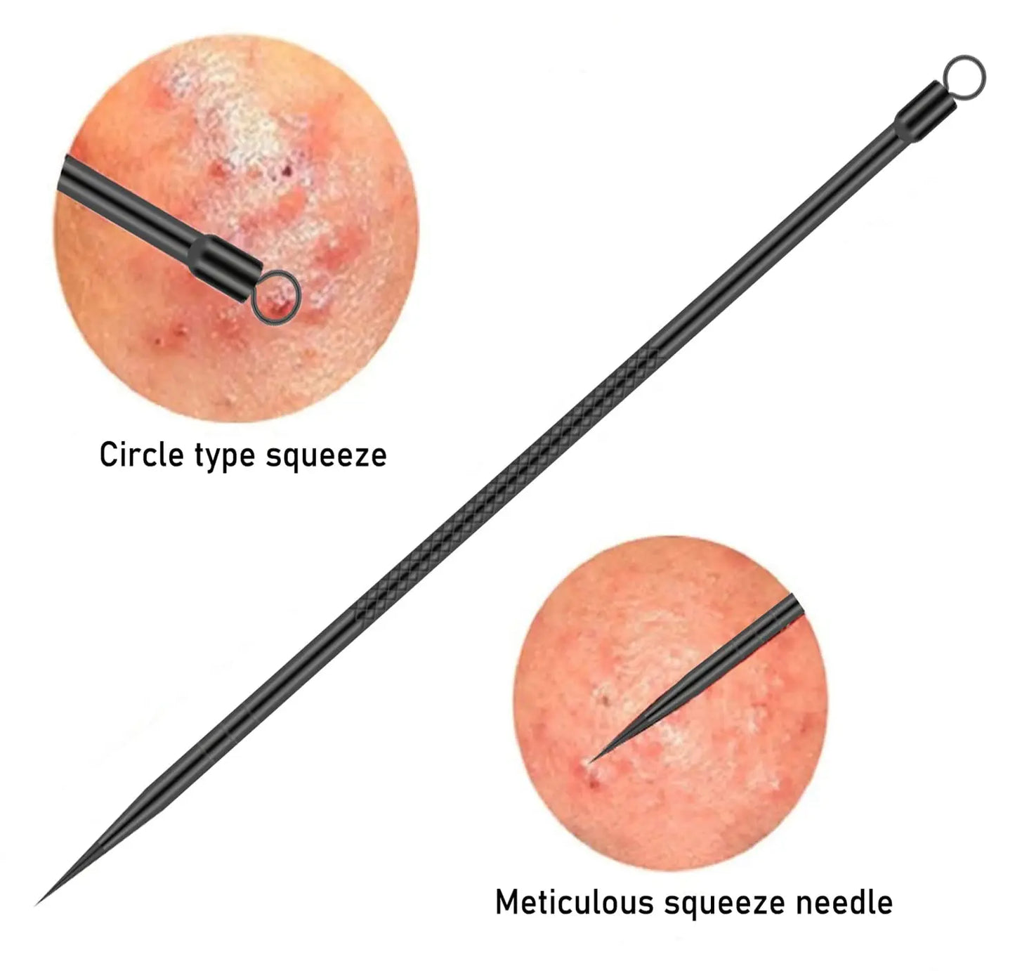 Professional Facial Blackhead Needle Set Stainless Steel Extractors