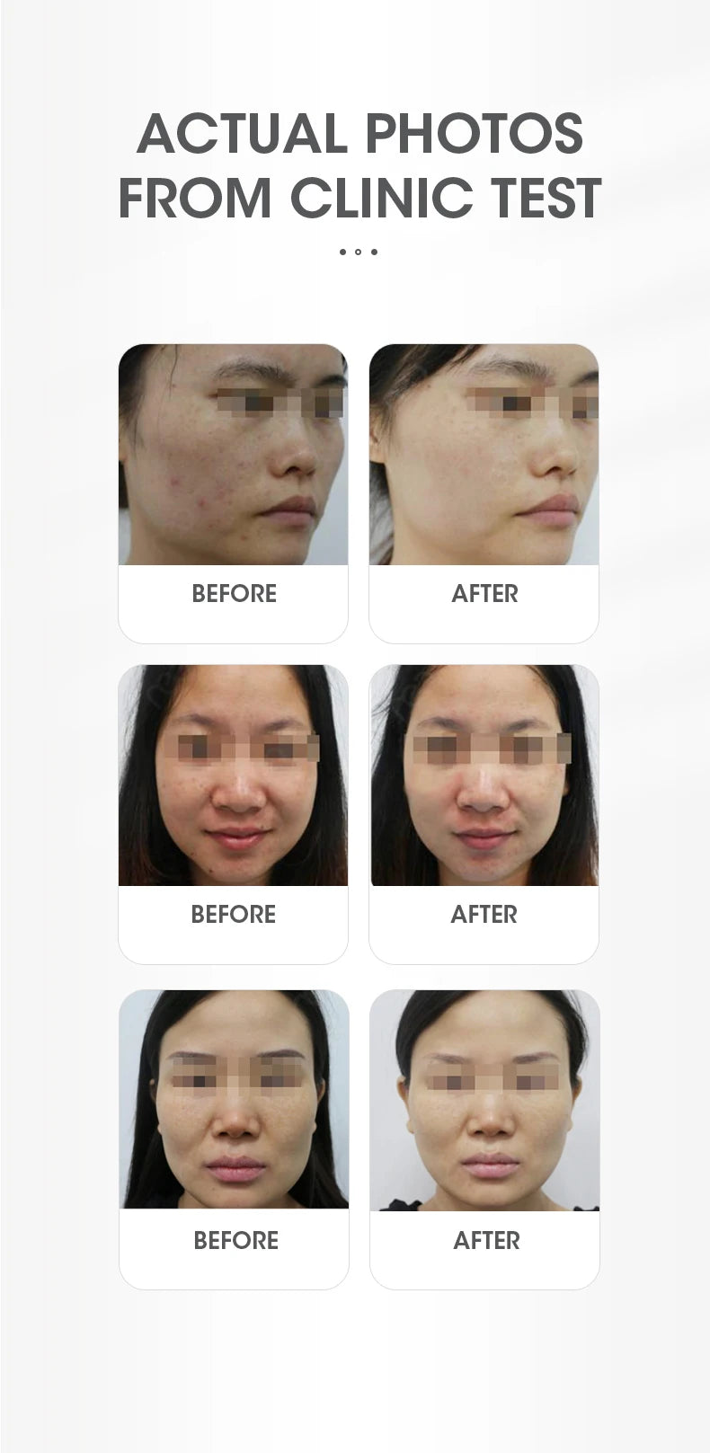 DEESS GP520 Facial Machine for Lifting and Anti Aging