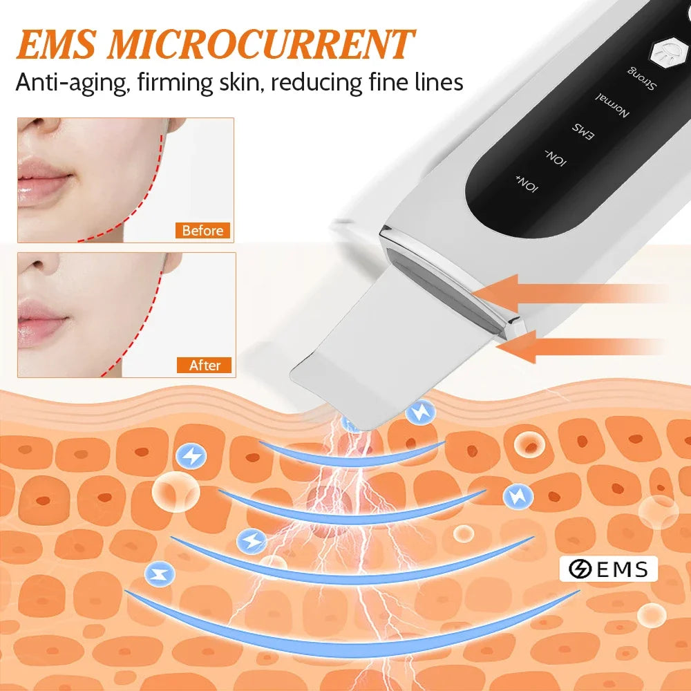 Ultrasonic Skin Scrubber Deep Clean Pore Cleanser Facial Spatula