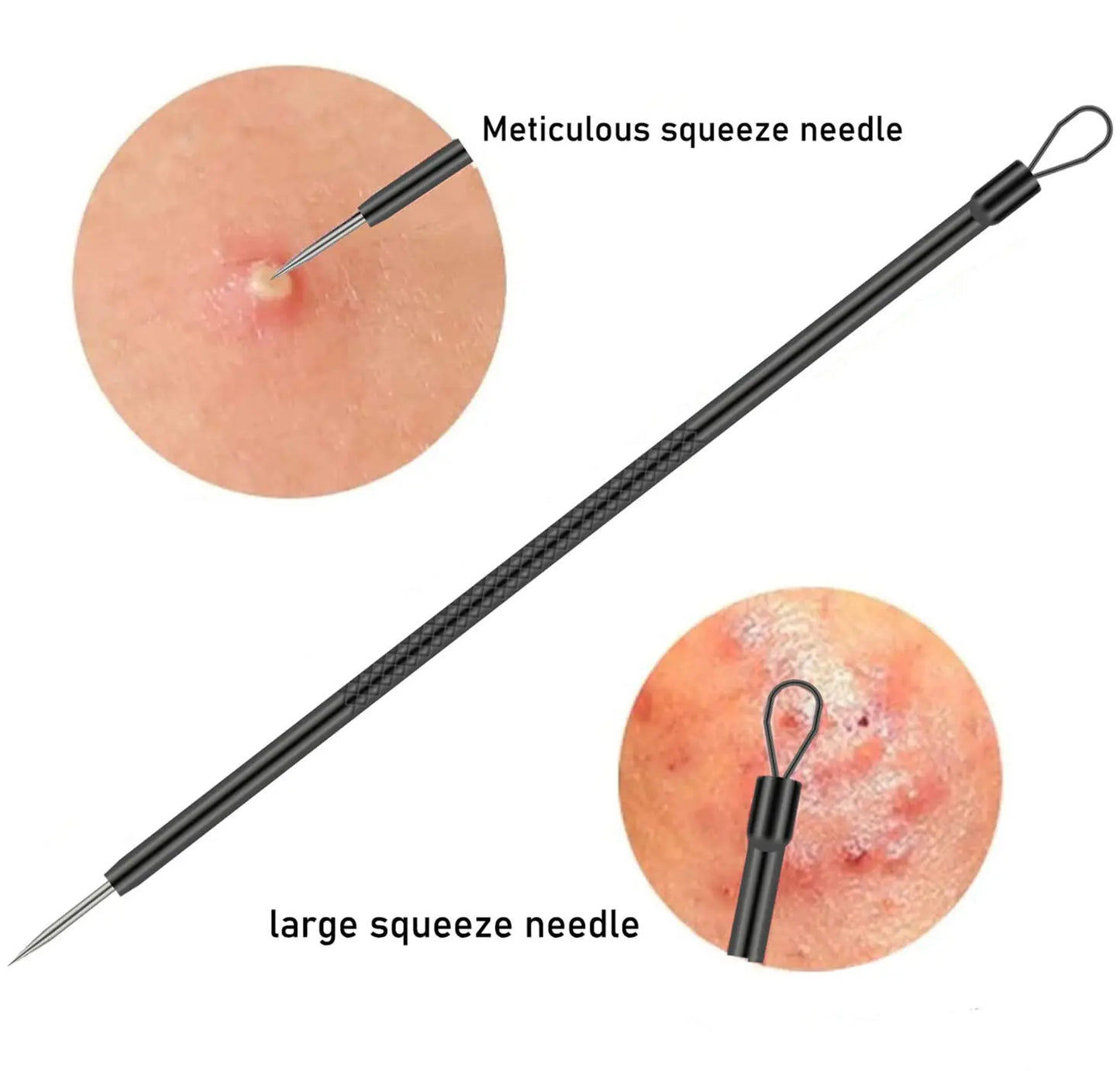 Professional Facial Blackhead Needle Set Stainless Steel Extractors