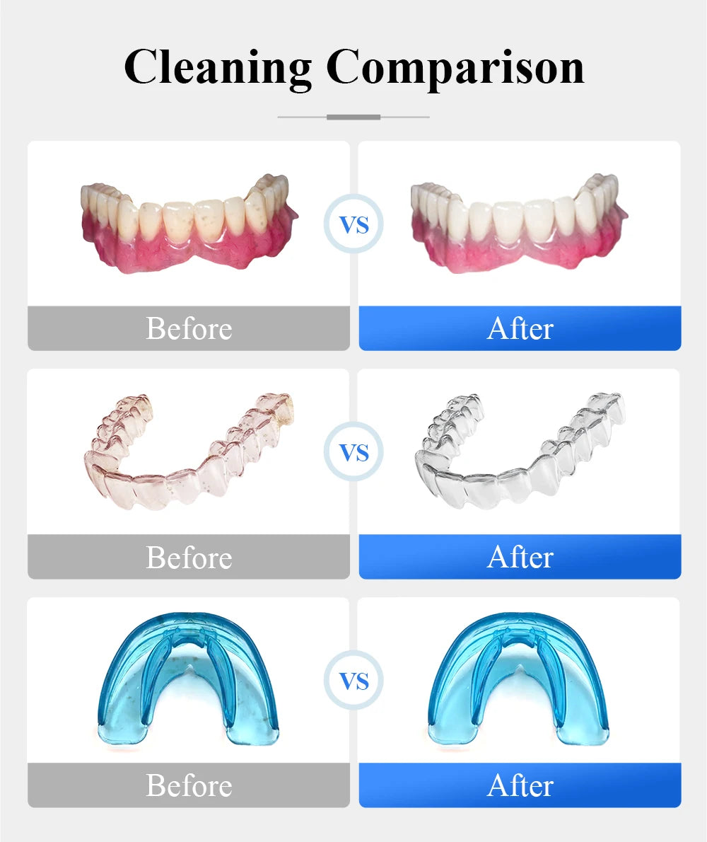 Tullker Ultrasonic Retainer Cleaner For Dentures Braces Jewelry