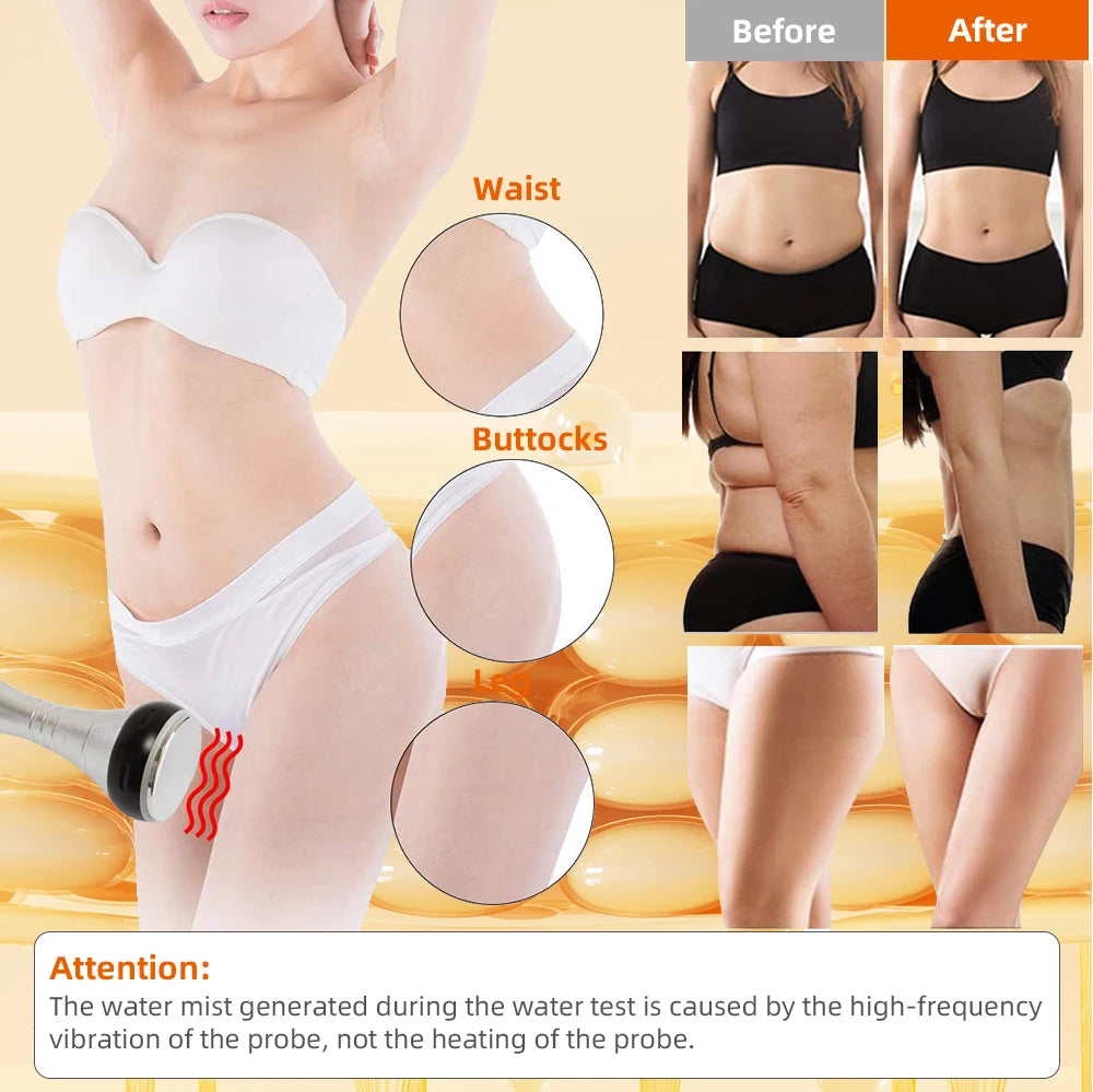Missheart Cavitation Ultrasonic Body Slimming Machine Vacuum Device