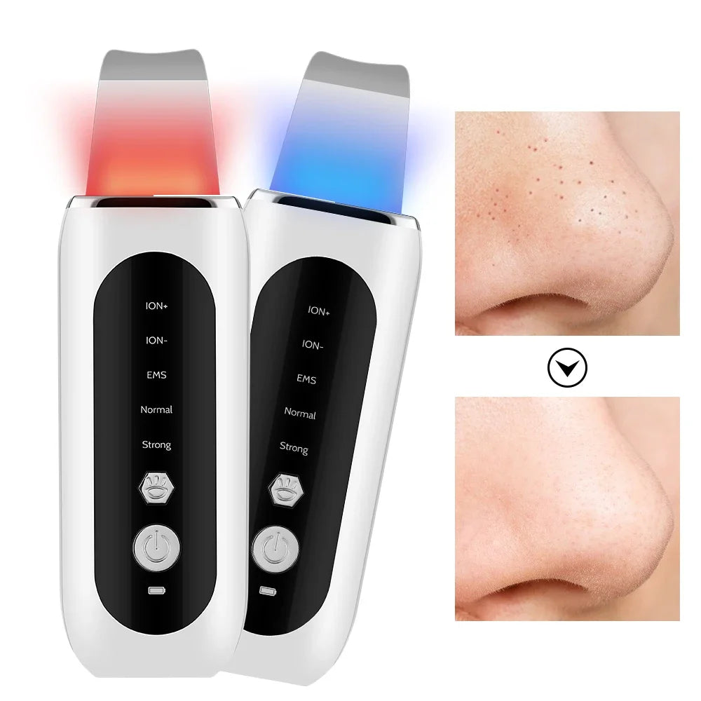 Ultrasonic Skin Scrubber Deep Clean Pore Cleanser Facial Spatula