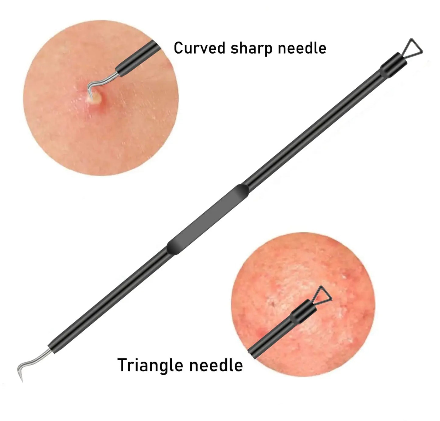 Professional Facial Blackhead Needle Set Stainless Steel Extractors