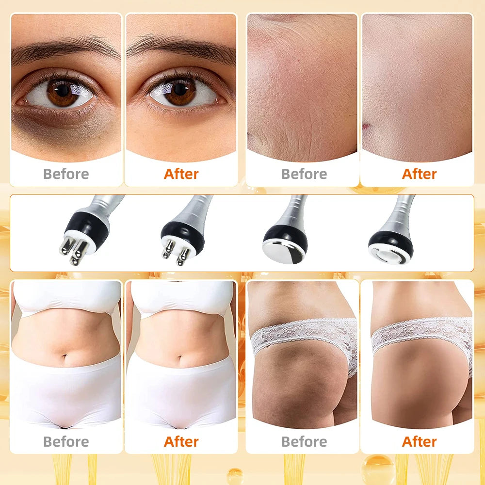 Missheart Cavitation Ultrasonic Body Slimming Machine Vacuum Device
