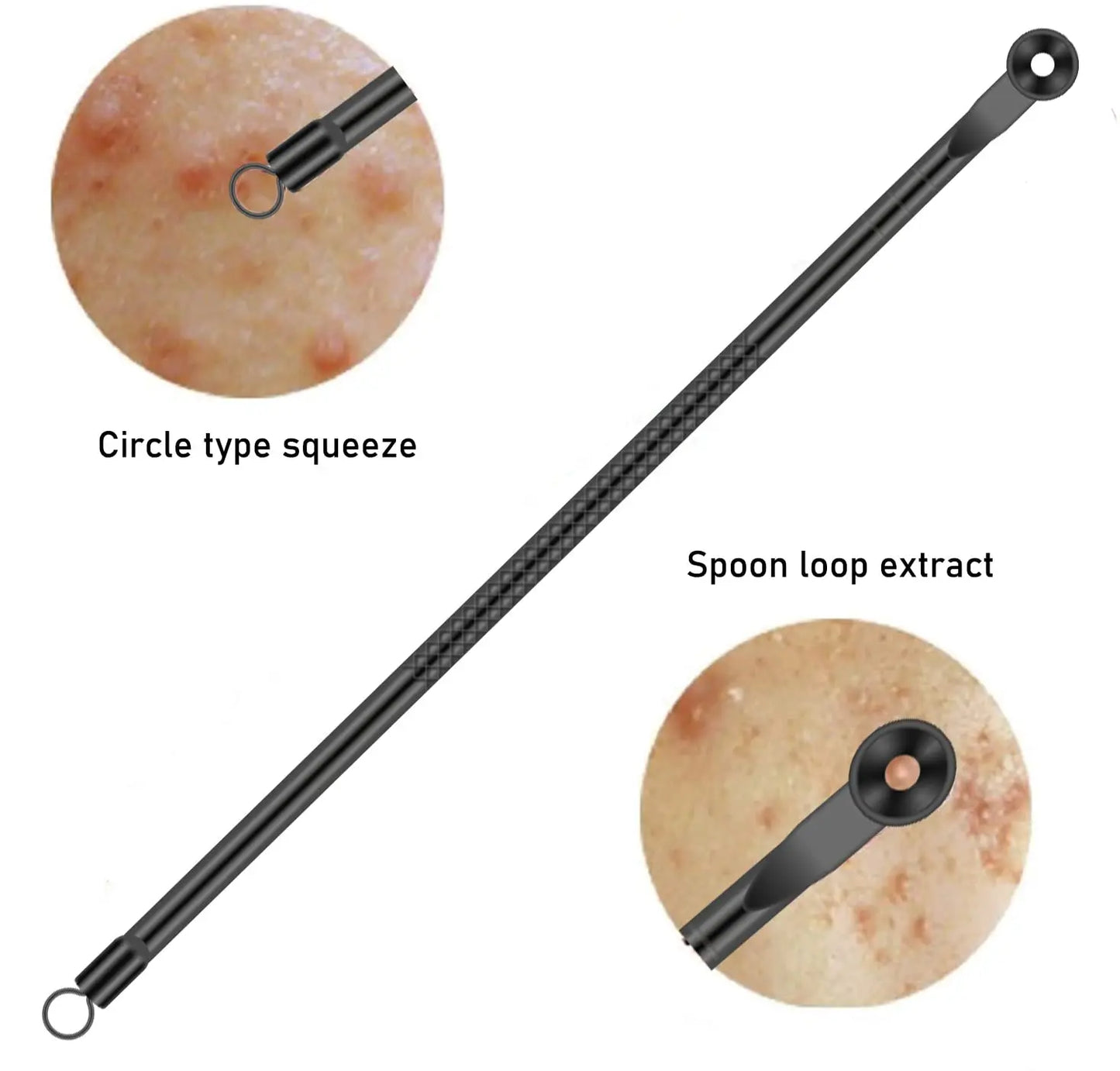 Professional Facial Blackhead Needle Set Stainless Steel Extractors